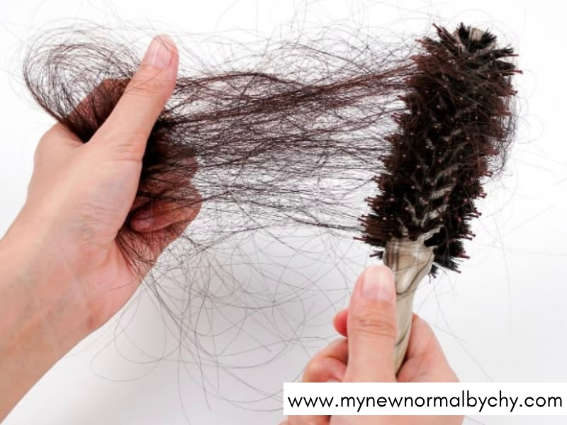 Can-You-Completely-Prevent-Postpartum-Hair-Shedding