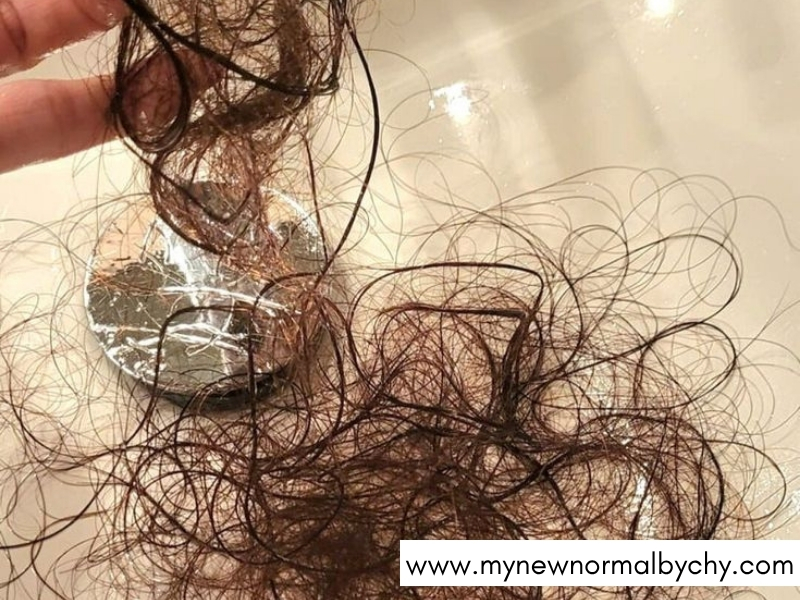 Featured-image-on-How-to-Stop-Postpartum-Hair-Shedding
