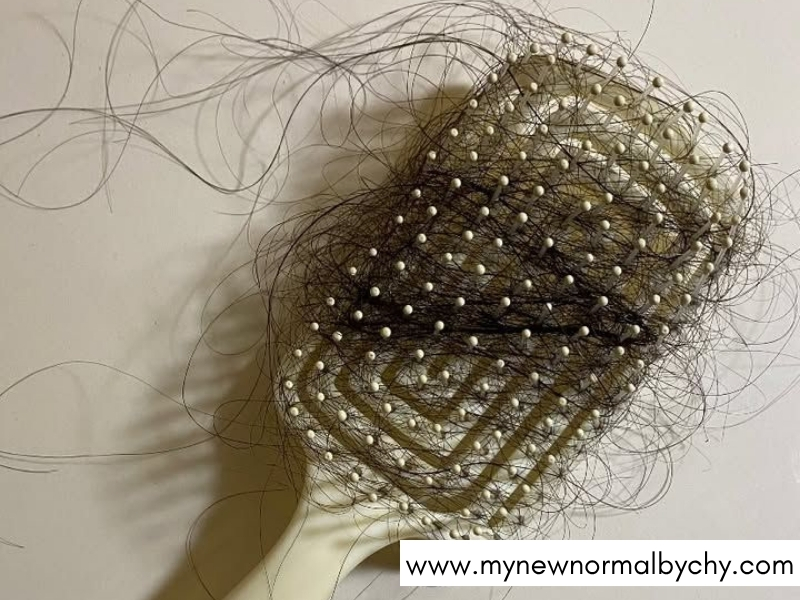 How-Long-Does-Postpartum-Hair-Shedding-Last