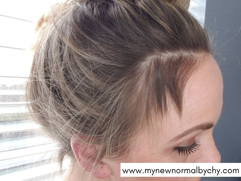 How-to-Stop-Postpartum-Hair-Shedding